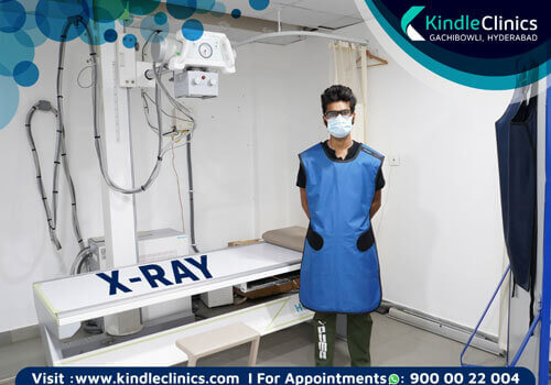 Best orthopedic Hospital in Hyderabad | Kindle Clinics